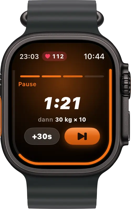 Mole auf der Apple Watch: Pause spüren