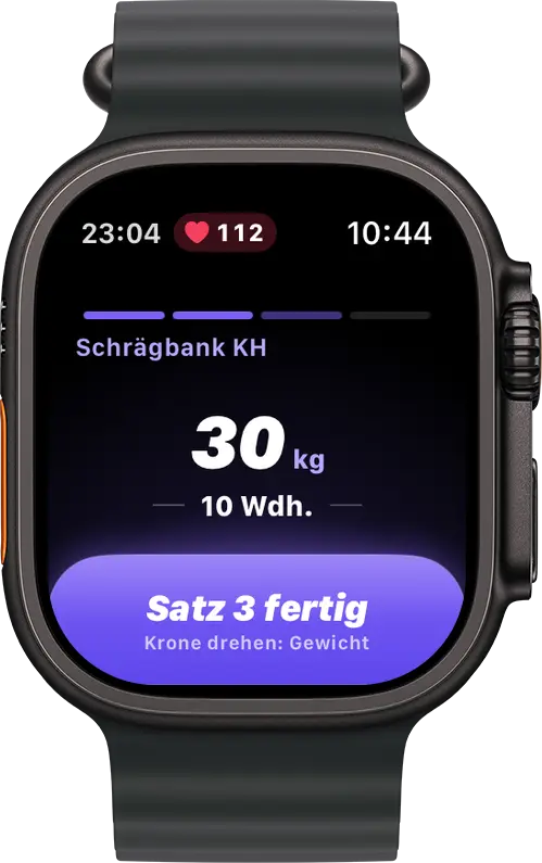 Mole auf der Apple Watch: Sätze abhaken
